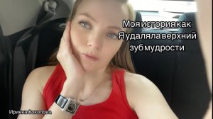 Удаление верхнего зуба мудрости | Моя История [Иринка Соколова ]