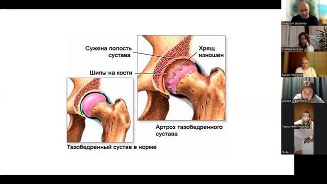 Как восстановить суставы