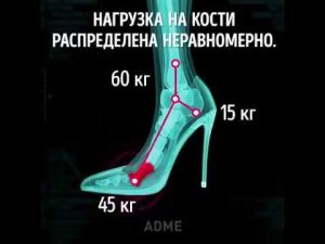 положение стопы в обуви на каблуках