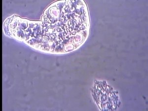 Коловратка под микроскопом (Habrotrocha constricta) | Rotifer under the microscope