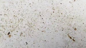 продолжаем контроль наличия клеща