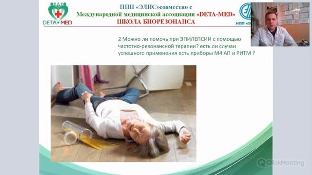 ЭПИЛЕПСИЯ