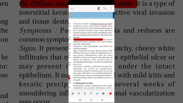 PYQ# herpes simplex keratitis# stromal keratitis смотреть онлайн