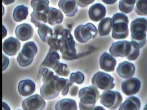 Макрофаги (free macrophages) Фазовый-контраст -They also know how to love each other