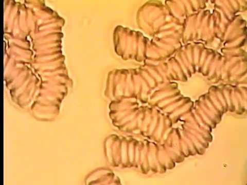 Кровь под микроскопом