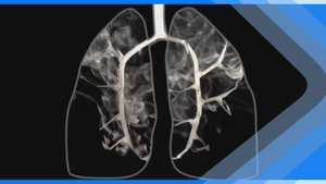 04.12.2024  Вред никотина на организм человека огромен