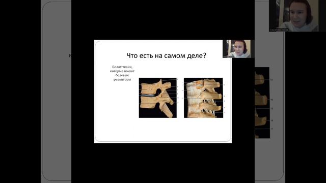 Что такое грыжа на самом деле?