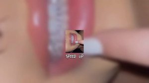 Платина - Каждый раз (speed up)