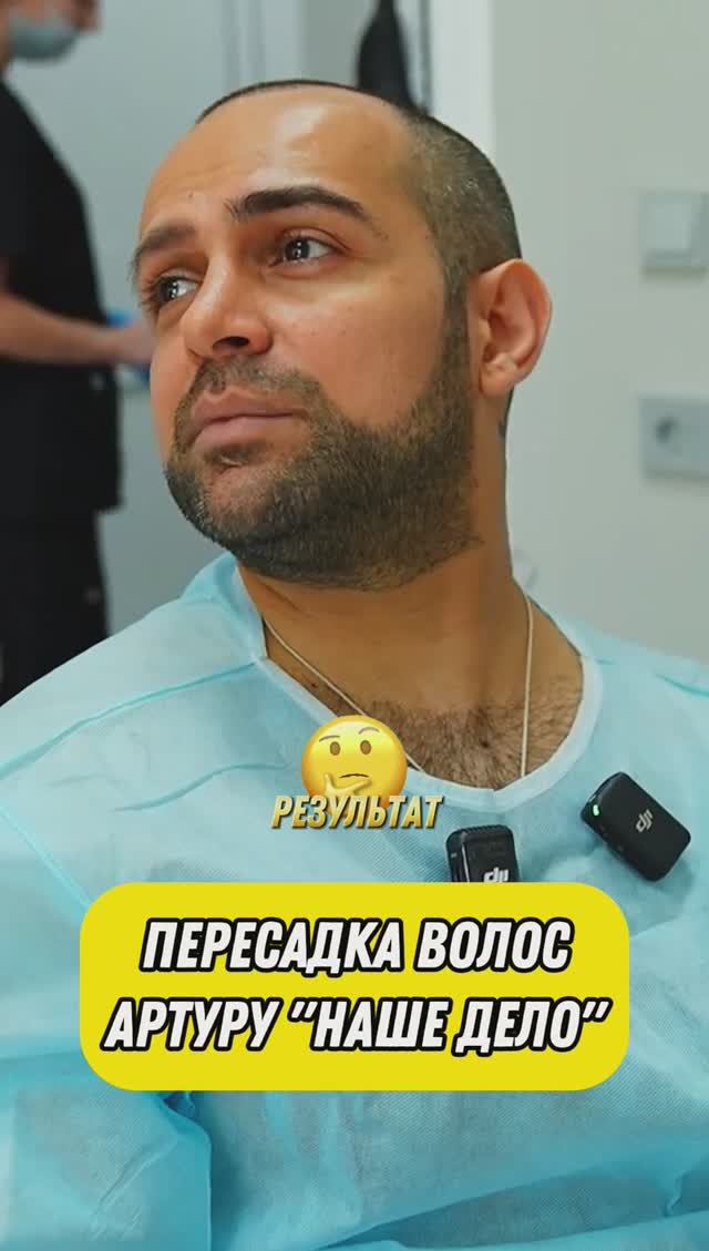 Артур Арутюнян пересадка в GGRAFT #пересадкаволосмосква #выпадениеволос #миноксидил #пересадкаволос