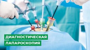 Диагностическая лапароскопия