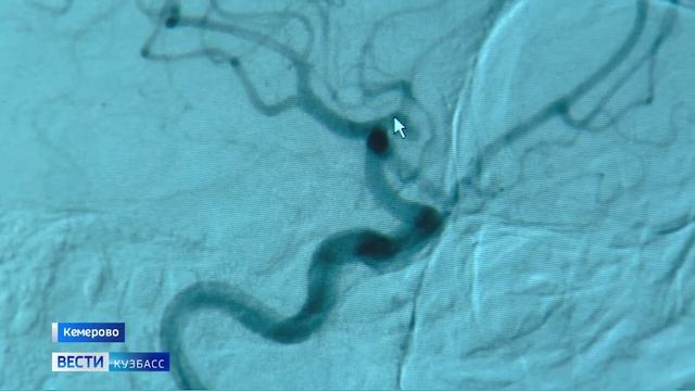 Кузбасские хирурги провели малоинвазивную операцию при геморрагическом инсульте