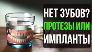 Нет ни одного зуба! Протезы или Импланты при полном отсутствии зубов?