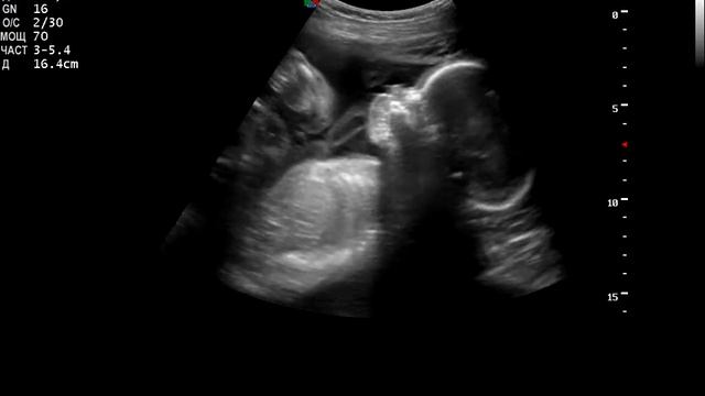 Вытягивает губы и кивает головой.avi смотреть онлайн