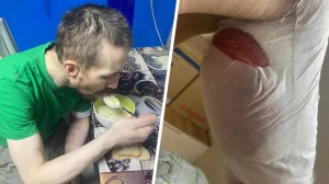 Ветеран СВО с гноящимися ранами оказался в социальном приюте