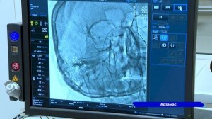 На базе Арзамасской ЦРБ проводят новые виды операций на сосудах головного мозга