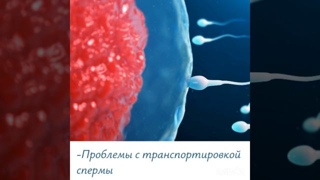 Лечение мужского бесплодия