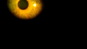 Ротаторный нистагм