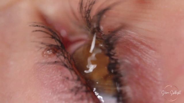 Aging Eye Problems: Common Symptoms and Solutions | aging eye problems symptoms смотреть онлайн