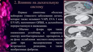 Неделя профилактики потребления никотинсодержащей продукции  - Макарова М.А.