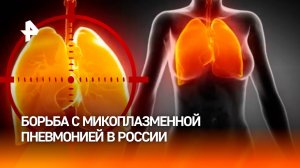 Число заболевших микоплазменной пневмонией снизилось в России / РЕН Новости