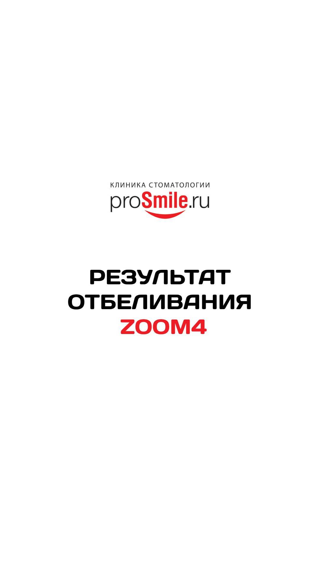 Результат отбеливания ZOOM4. Работа Свиридовой А.А.