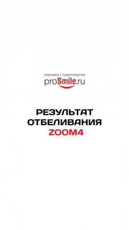 Результат отбеливания ZOOM4. Работа Свиридовой А.А.