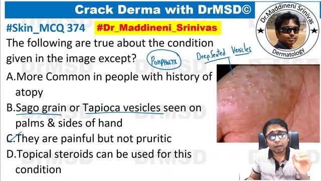 Dyshidrotic Eczema | POMPHOLYX | Causes, Symptoms, Diagnosis & Treatment by Dr Maddineni Srinivas |