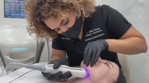 Игольчатый RF-лифтинг Virtue RF