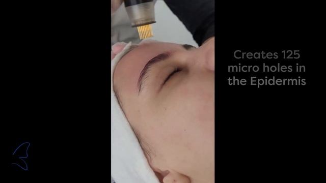 Natural Skin Renewal with Imperium Deep Restoration