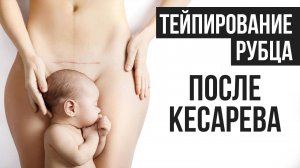 ТЕЙПИРОВАНИЕ РУБЦА ПОСЛЕ КЕСАРЕВА СЕЧЕНИЯ. Дмитрий Горковский и Марина Осокина