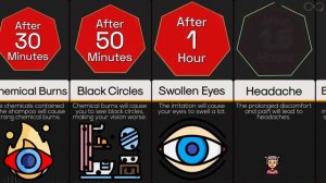 Timeline: What If You Put Shampoo In Your Eyes Non-stop