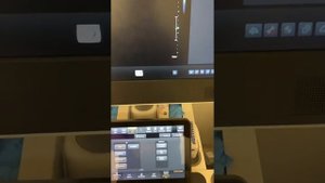 Как на аппарате УЗИ Philips сохранять видеоклип и скидывать на флешку.