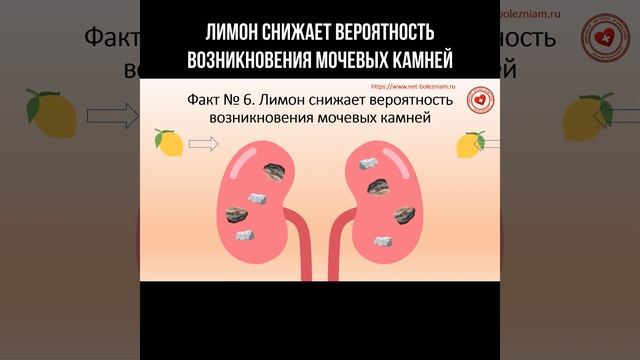 Лимон снижает вероятность возникновения мочевых камней #лимон #камнивпочках