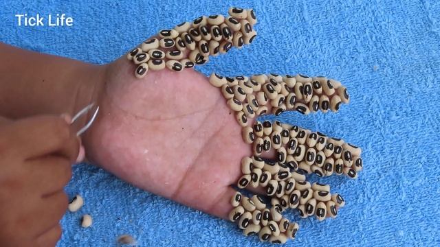 How to remove strange ticks style on hand poor lady  Ticks designed by cereals 148