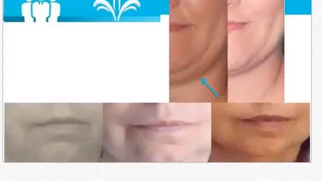 Омоложение на клеточном уровне. Компания Jeuness Global
