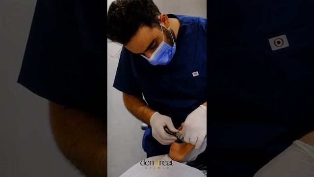 Preparing for Zirconium Crowns🦷 смотреть онлайн