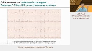 ЭКГ при стенокардии