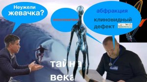 Ударные волны 2 - Основной фактор абфракций… «клиновидные волны»