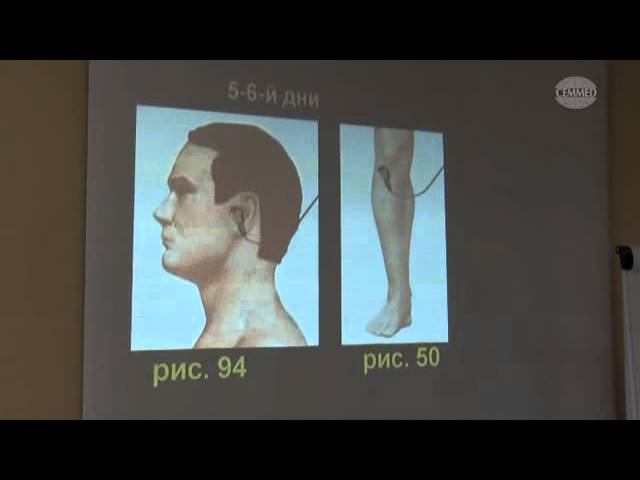 Часть 8. Сахарный диабет 1 и 2 типа. Бессонница (зоны сна).Сосудистые нарушения. Диабетическая стопа