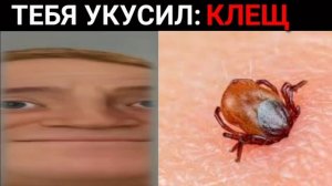 Тебя укусил: