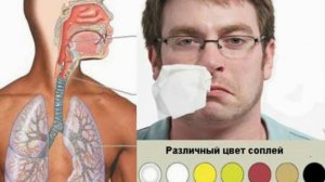 Kattalarda va bolalarda burun bitishi sabablari, oqibatlari va davolash