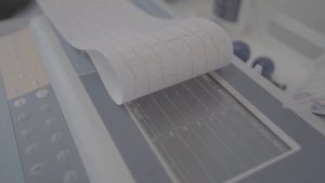 СКРЫТЫЕ СИМПТОМЫ РАКА КИШЕЧНИКА | Ранние признаки рака кишечника