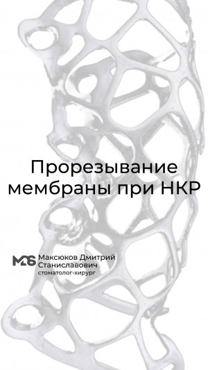 ⛓💥Прорезывание мембраны при НКР