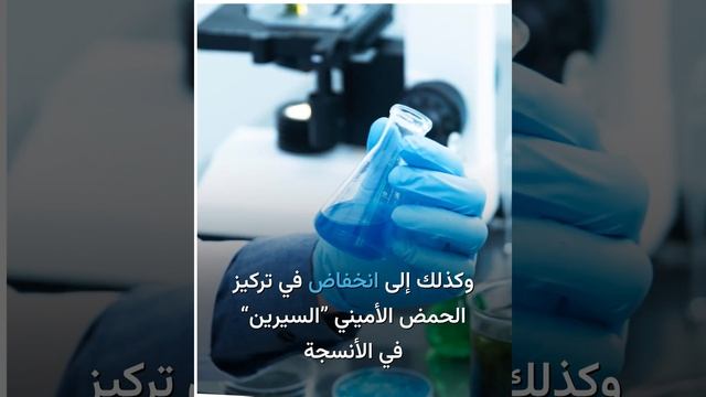 دراسة تشير إلى أن شيخوخة الدماغ مرتبطة بخلل في البروتينات في خلايا منطقة ما تحت المهاد.