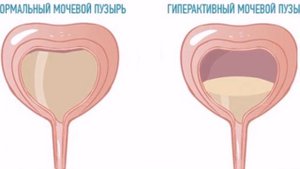 Ковук Касалликлари Хакида !!!