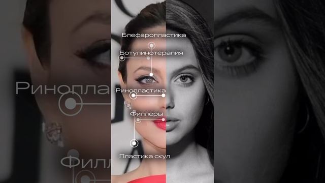 Изменения во внешности Анджелины Джоли.