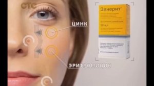 "Зинерит - безупречный внешний вид"