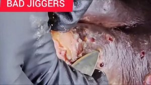 Remove Jiggers from foot 🦶🦶😳🐜Bad Jiggers investation🐜🐜😭