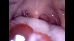 Swallowing Gummy Bears | Mouth Cam