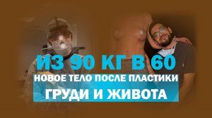 Комплексная пластика для мамы троих детей: результат потрясающий